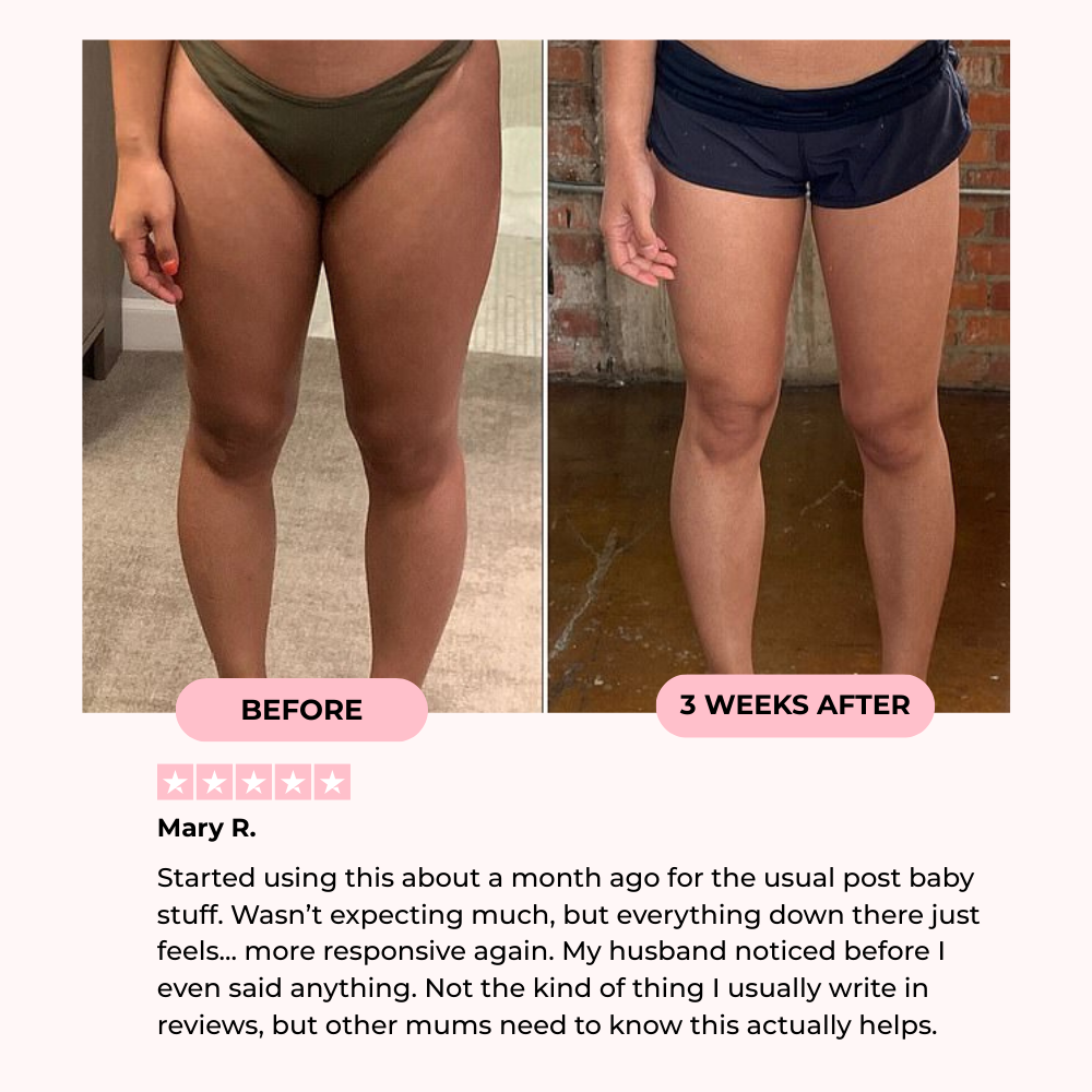 EUHRA™ Thigh & Pelvic Trainer